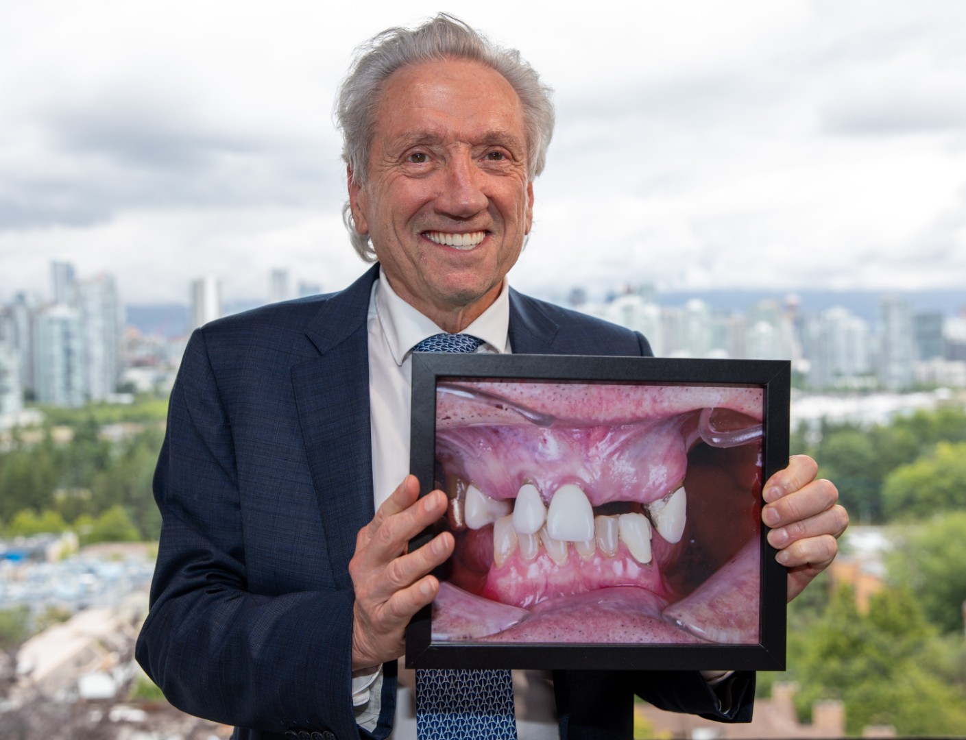 Dental Restoration Patient